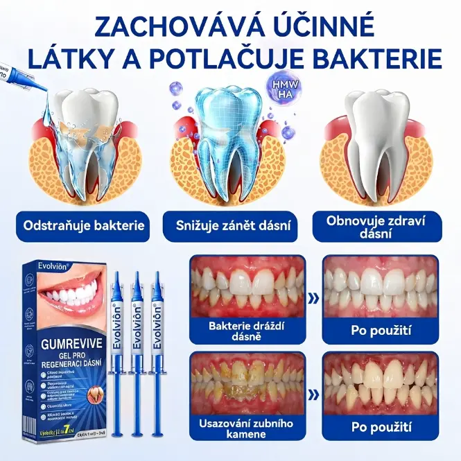 𝐄𝐯𝐨𝐥𝐯𝐢𝐨𝐧® 𝐆𝐮𝐦𝐑𝐞𝐯𝐢𝐯𝐞 𝐆𝐞𝐥 𝐩𝐫𝐨 𝐫𝐞𝐠𝐞𝐧𝐞𝐫𝐚𝐜𝐢 𝐩𝐚𝐫𝐨𝐝𝐨𝐧𝐭𝐮