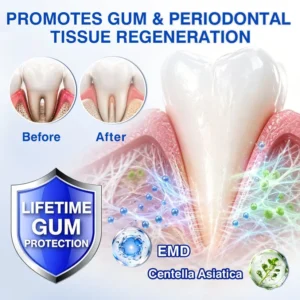 𝐍𝐚𝐭𝐫𝐚𝐯𝐨𝐫® GumRevive Gum Regeneration Gel