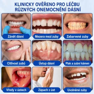 🇨🇿 HEATWOLF® 🦷 GumRevive parodontální opravný gel🥚