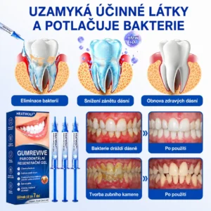 🇨🇿 HEATWOLF® 🦷 GumRevive parodontální opravný gel🥚