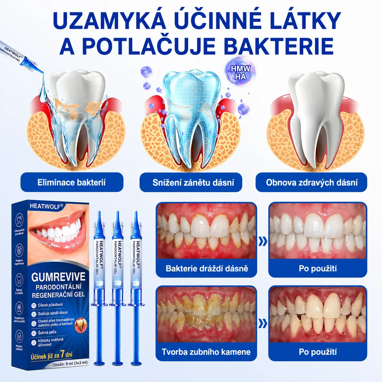 🇨🇿 HEATWOLF® 🦷 GumRevive parodontální opravný gel🥚