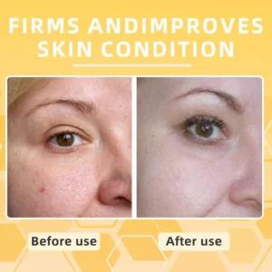 Skavix™ BeeToxLift Firming & Wrinkle-Reducing Cream