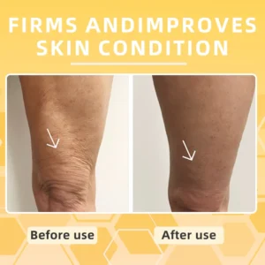 Skavix™ BeeToxLift Firming & Wrinkle-Reducing Cream