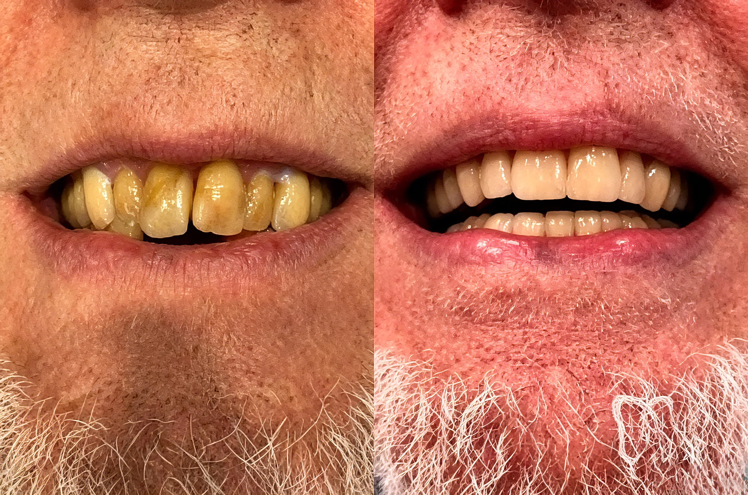 GumRevive Periodontal Repair Gel