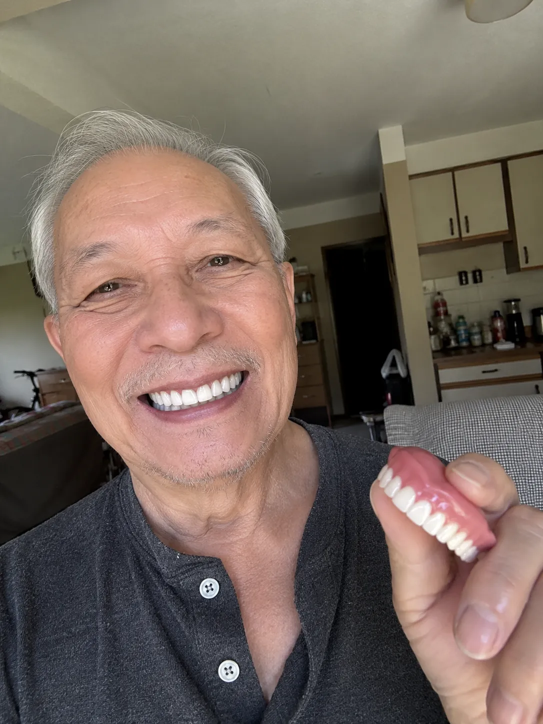 BRONY™ Second-Generation Complete Dentures