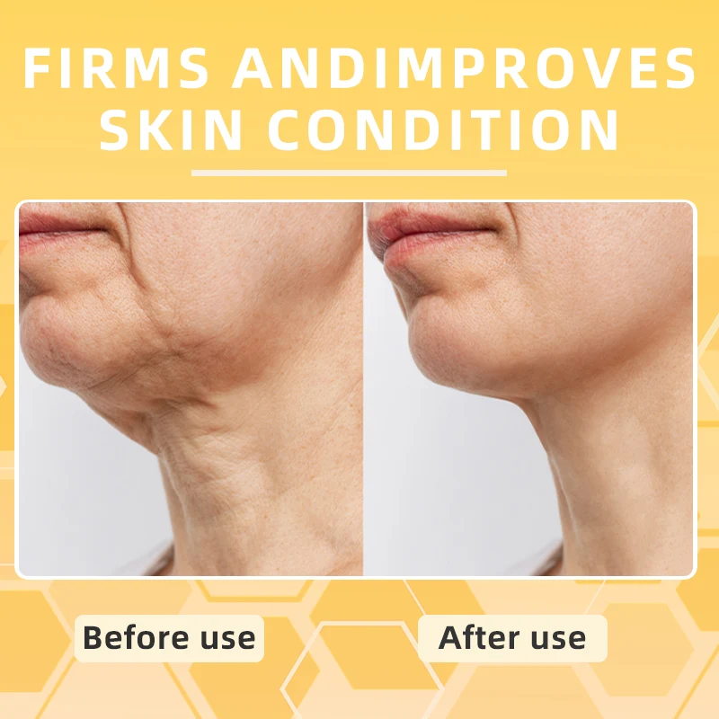 Skavix™ BeeToxLift Firming & Wrinkle-Reducing Cream