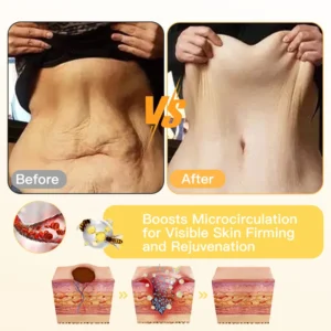 Skavix™ BeeToxLift Firming & Wrinkle-Reducing Cream
