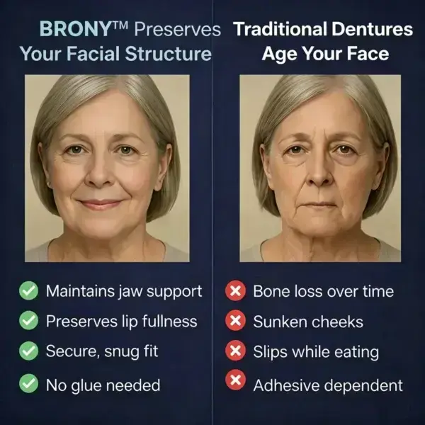BRONY™ Second-Generation Complete Dentures