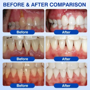 Dr.Era GumRevive Advanced Gum Care Gel