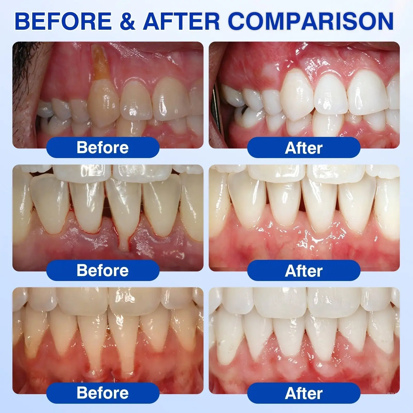 Dr.Era GumRevive Advanced Gum Care Gel