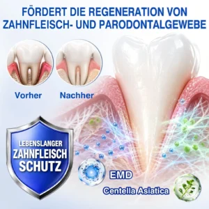 Evolvion® GumRevive Parodontales Reparaturgel