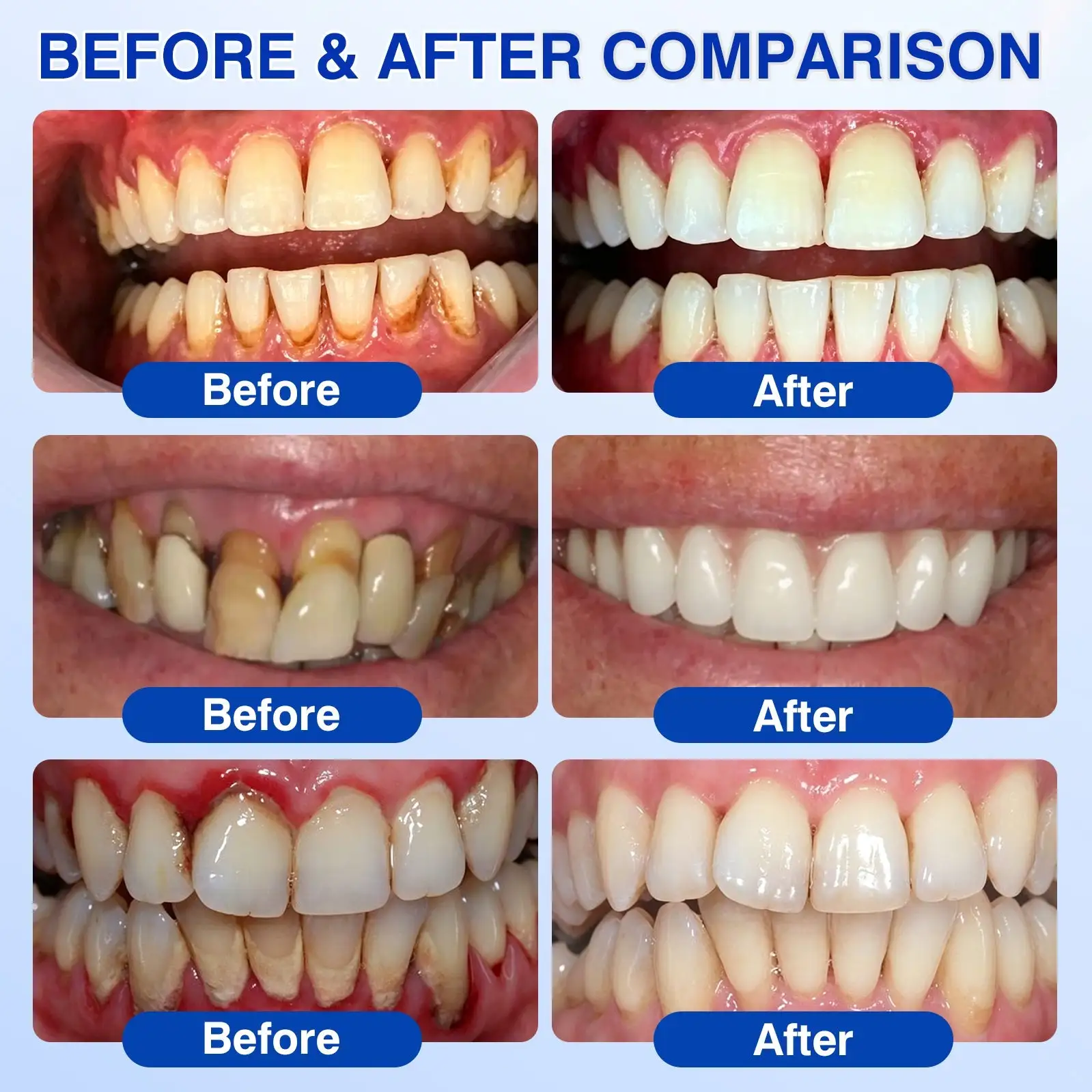 Evolvion® GumRevive Periodontal Repair Gel