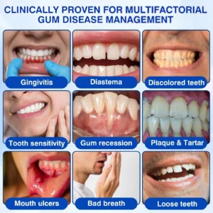 Evolvion® GumRevive Periodontal Repair Gel