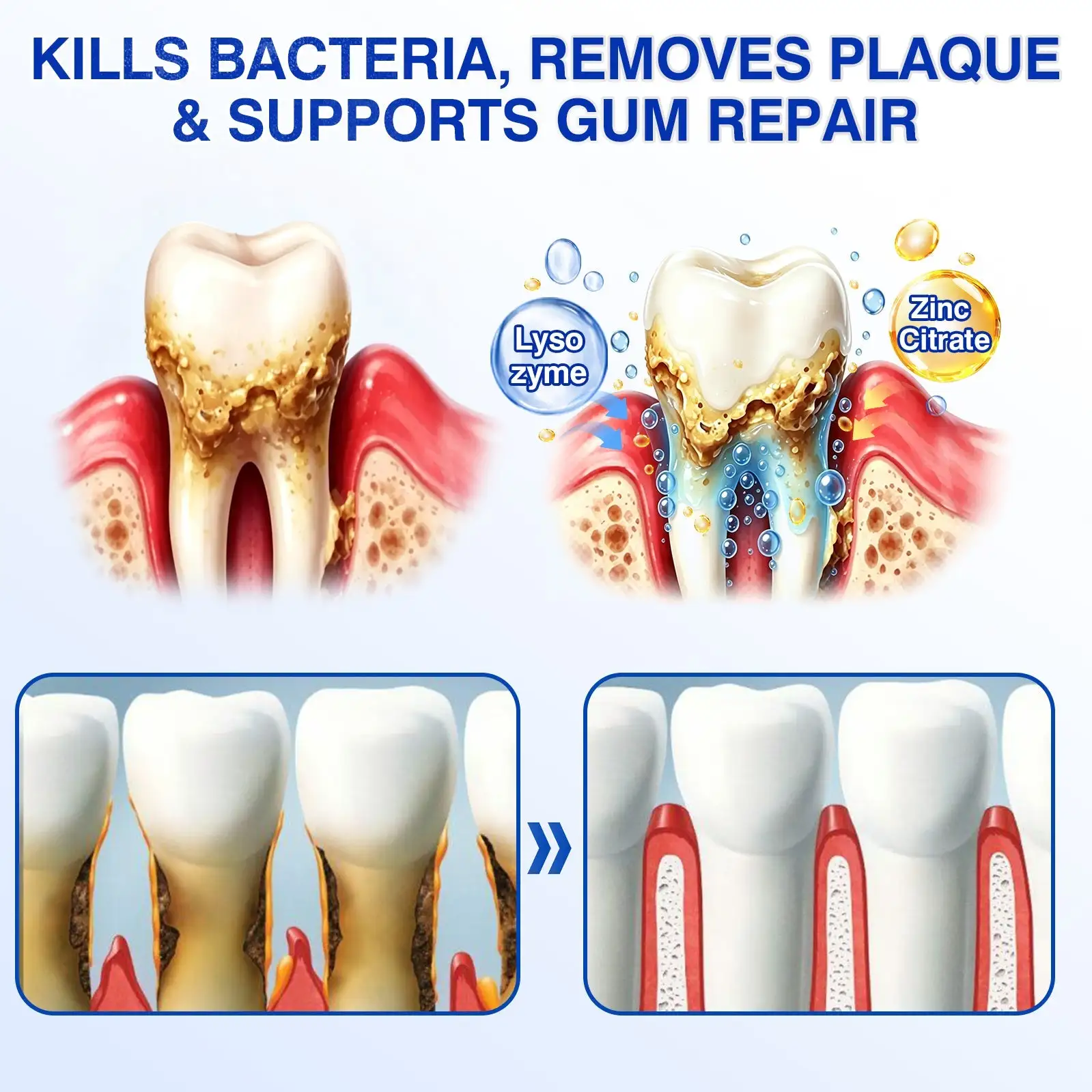 Evolvion® GumRevive Periodontal Repair Gel