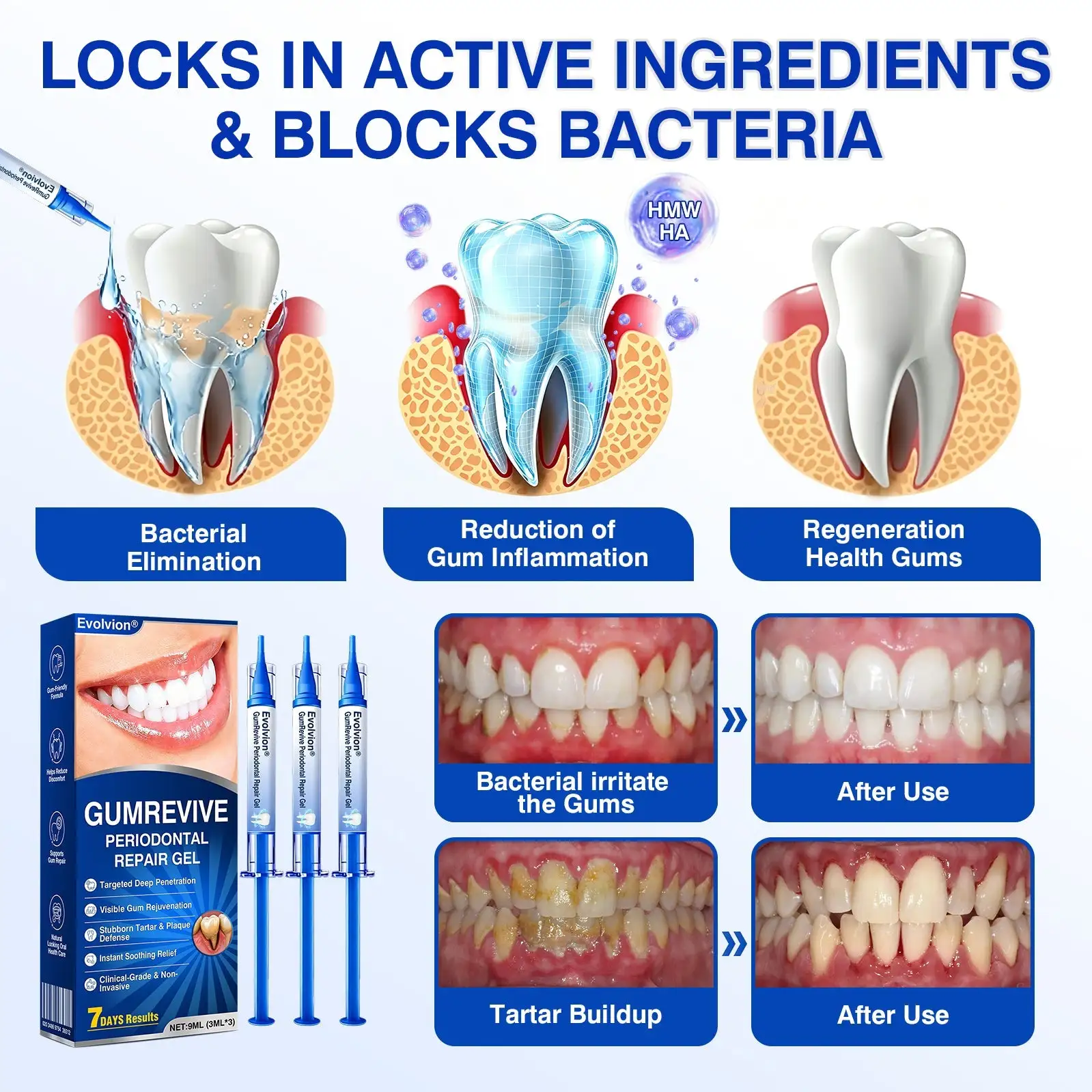 Evolvion® GumRevive Periodontal Repair Gel