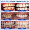 Glimmerly® GumRevive Periodontal Repair Gel