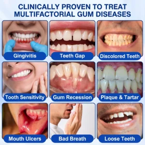 Glimmerly® GumRevive Periodontal Repair Gel