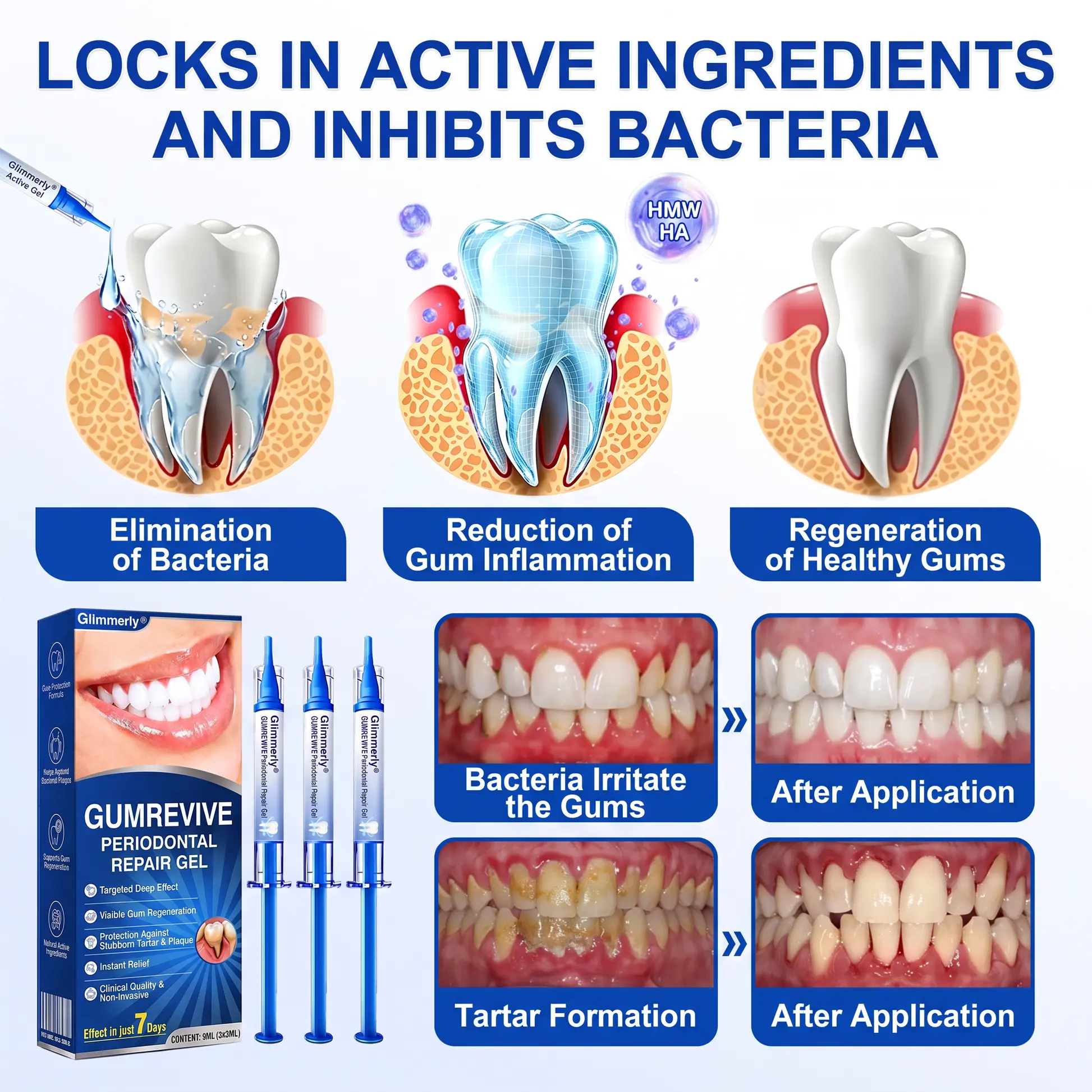 GumRevive Periodontal Repair Gel