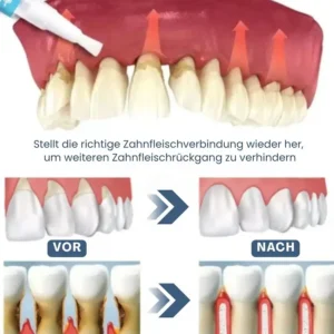 GumRevive™ | Zahnfleisch Sofort-Gel