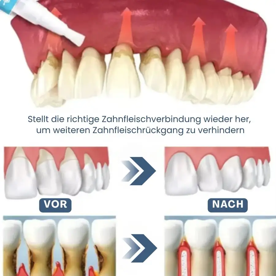 GumRevive™ | Zahnfleisch Sofort-Gel