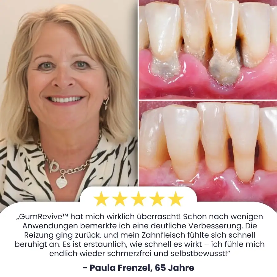 GumRevive™ | Zahnfleisch Sofort-Gel