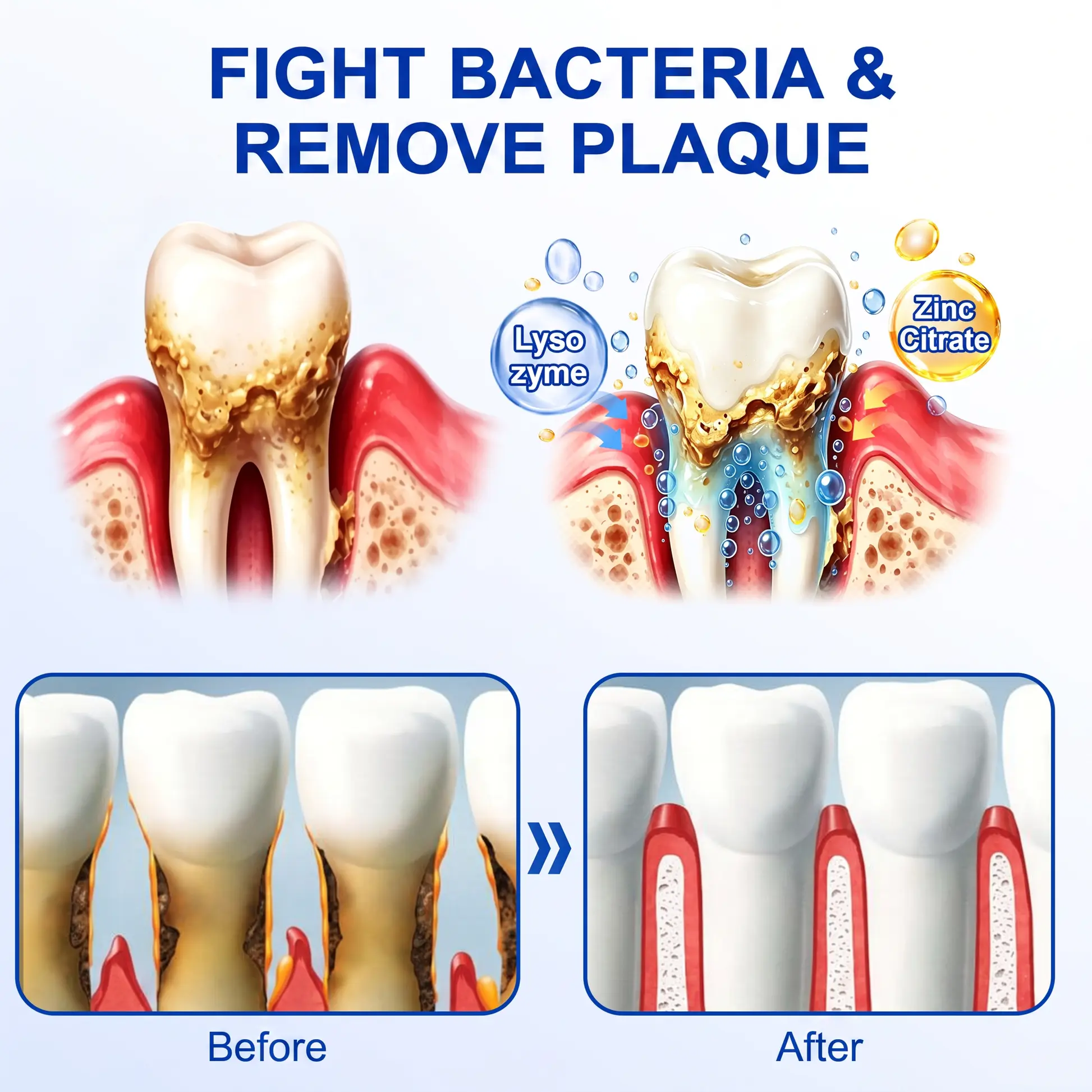 SOLAROZA® GumRevive Periodontal Repair Gel