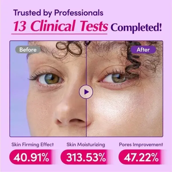 Skavix™ Pore Tightening Serum