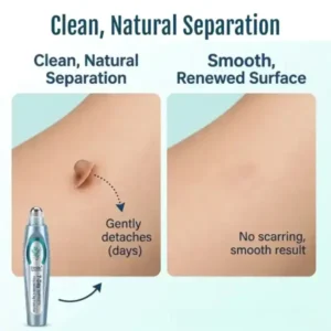 Timilk® SpotlessPro Advanced Skin Care Pen