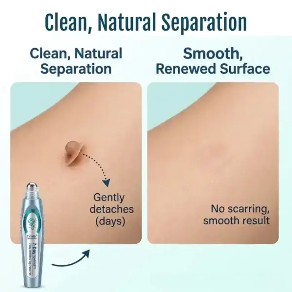 Timilk® SpotlessPro Advanced Skin Care Pen