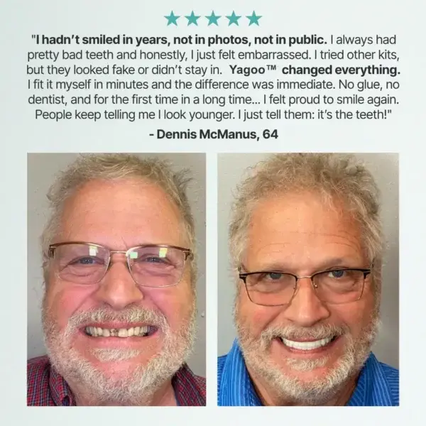 Yagoo™ Custom Custom-Fit Full Functional Dentures