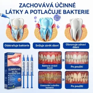 https://www.evolvion.org/product/evolvion-gumrevive-gel-emd-hyaluronic-x7kq/