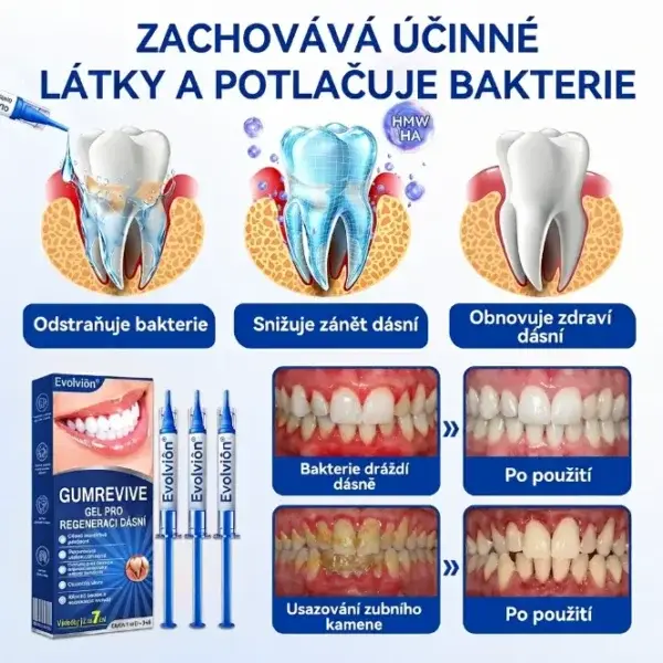 https://www.evolvion.org/product/evolvion-gumrevive-gel-emd-hyaluronic-x7kq/