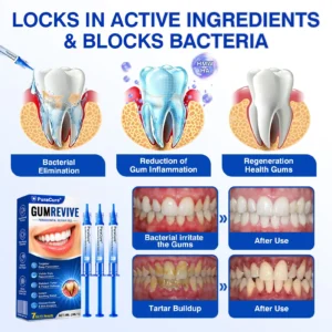 𝐏𝐮𝐫𝐚𝐂𝐮𝐫𝐞® 𝐆𝐮𝐦𝐑𝐞𝐯𝐢𝐯𝐞 𝐏𝐞𝐫𝐢𝐨𝐝𝐨𝐧𝐭𝐚𝐥 𝐑𝐞𝐩𝐚𝐢𝐫 𝐆𝐞𝐥