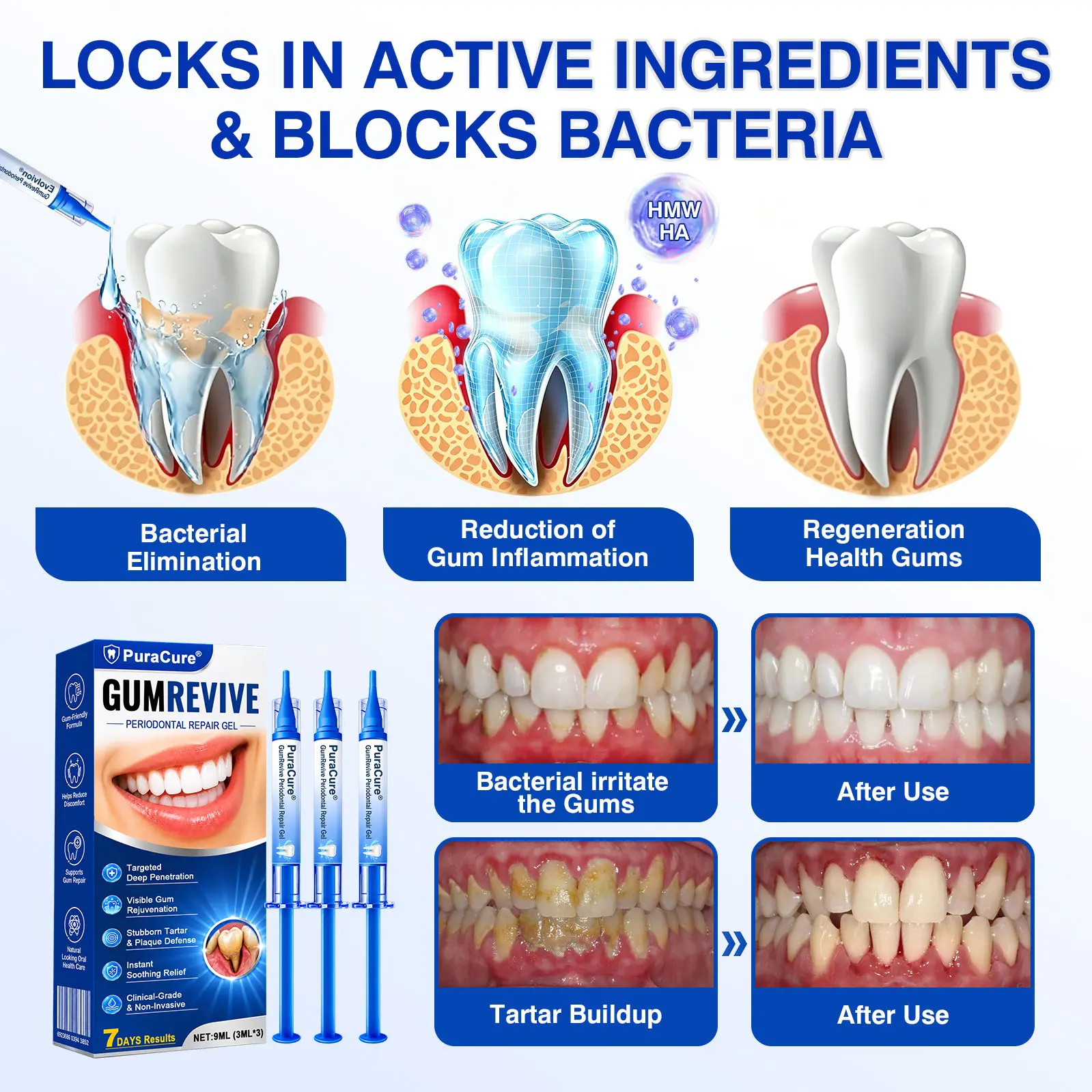 𝐏𝐮𝐫𝐚𝐂𝐮𝐫𝐞® 𝐆𝐮𝐦𝐑𝐞𝐯𝐢𝐯𝐞 𝐏𝐞𝐫𝐢𝐨𝐝𝐨𝐧𝐭𝐚𝐥 𝐑𝐞𝐩𝐚𝐢𝐫 𝐆𝐞𝐥