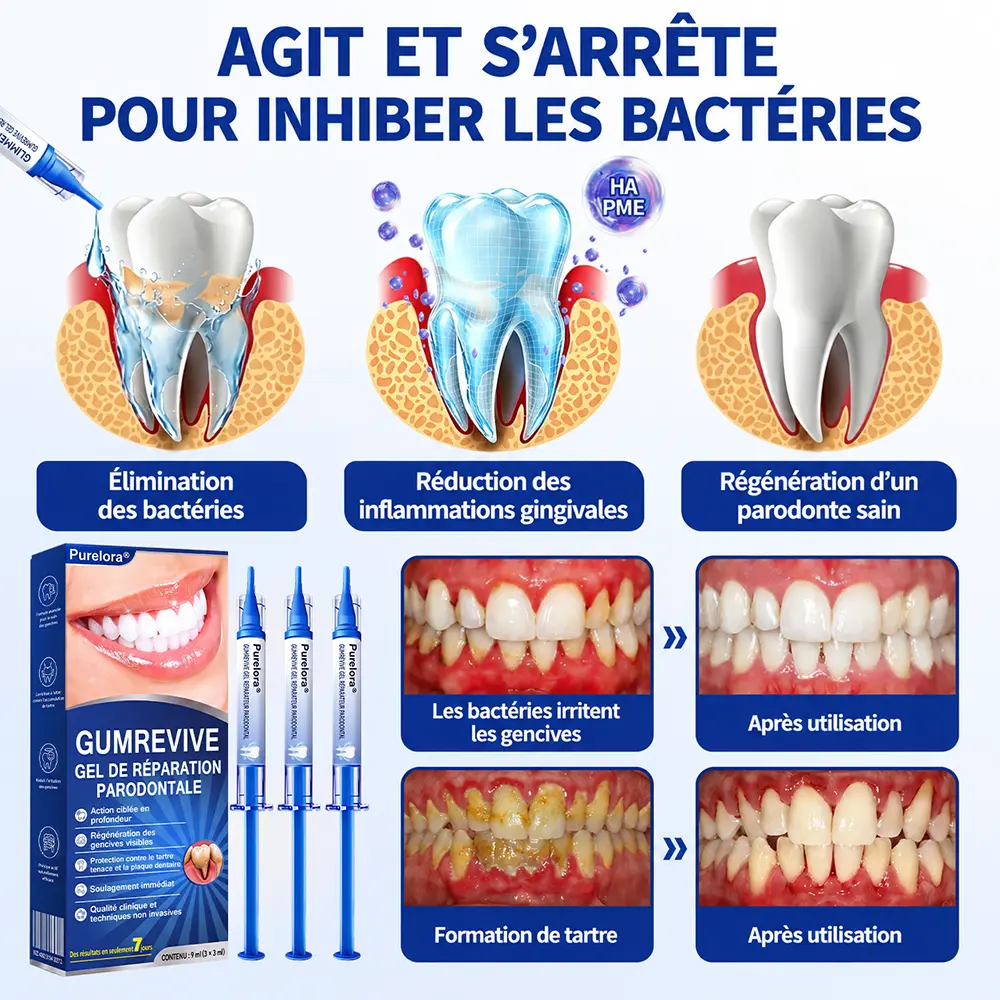 𝑷𝒖𝒓𝒆𝒍𝒐𝒓𝒂® 𝑮𝒖𝒎𝑹𝒆𝒗𝒊𝒗𝒆 𝑮𝒆𝒍 𝒅𝒆 𝑹é𝒑𝒂𝒓𝒂𝒕𝒊𝒐𝒏 𝑷𝒂𝒓𝒐𝒅𝒐𝒏𝒕𝒂𝒍𝒆