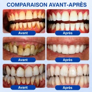 𝑷𝒖𝒓𝒆𝒍𝒐𝒓𝒂® 𝑮𝒖𝒎𝑹𝒆𝒗𝒊𝒗𝒆 𝑮𝒆𝒍 𝒅𝒆 𝑹é𝒑𝒂𝒓𝒂𝒕𝒊𝒐𝒏 𝑷𝒂𝒓𝒐𝒅𝒐𝒏𝒕𝒂𝒍𝒆
