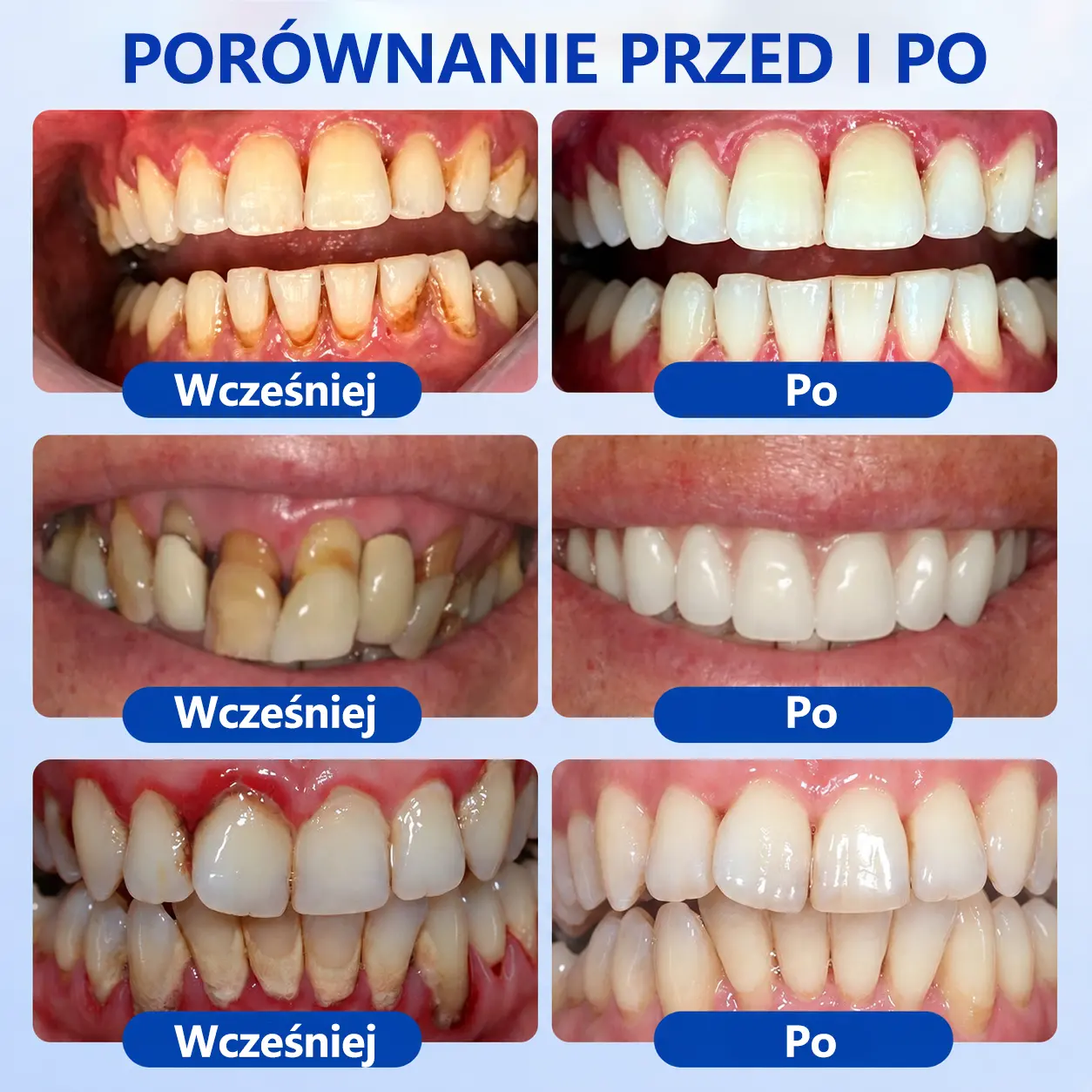 𝑮𝒍𝒊𝒎𝒎𝒆𝒓𝒍𝒚® 𝑮𝒖𝒎𝑹𝒆𝒗𝒊𝒗𝒆 Ż𝒆𝒍 𝒅𝒐 𝒓𝒆𝒈𝒆𝒏𝒆𝒓𝒂𝒄𝒋𝒊 𝒅𝒛𝒊ą𝒔𝒆ł