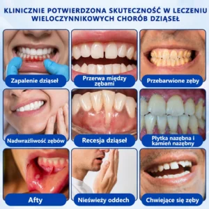 𝑮𝒍𝒊𝒎𝒎𝒆𝒓𝒍𝒚® 𝑮𝒖𝒎𝑹𝒆𝒗𝒊𝒗𝒆 Ż𝒆𝒍 𝒅𝒐 𝒓𝒆𝒈𝒆𝒏𝒆𝒓𝒂𝒄𝒋𝒊 𝒅𝒛𝒊ą𝒔𝒆ł