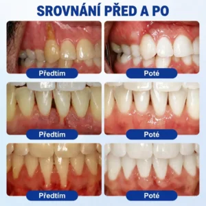 𝐕𝐢𝐭𝐚𝐥𝐢𝐬𝐲𝐬® Parodontální Regenerační Gel GumRevive