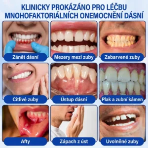 𝐕𝐢𝐭𝐚𝐥𝐢𝐬𝐲𝐬® Parodontální Regenerační Gel GumRevive