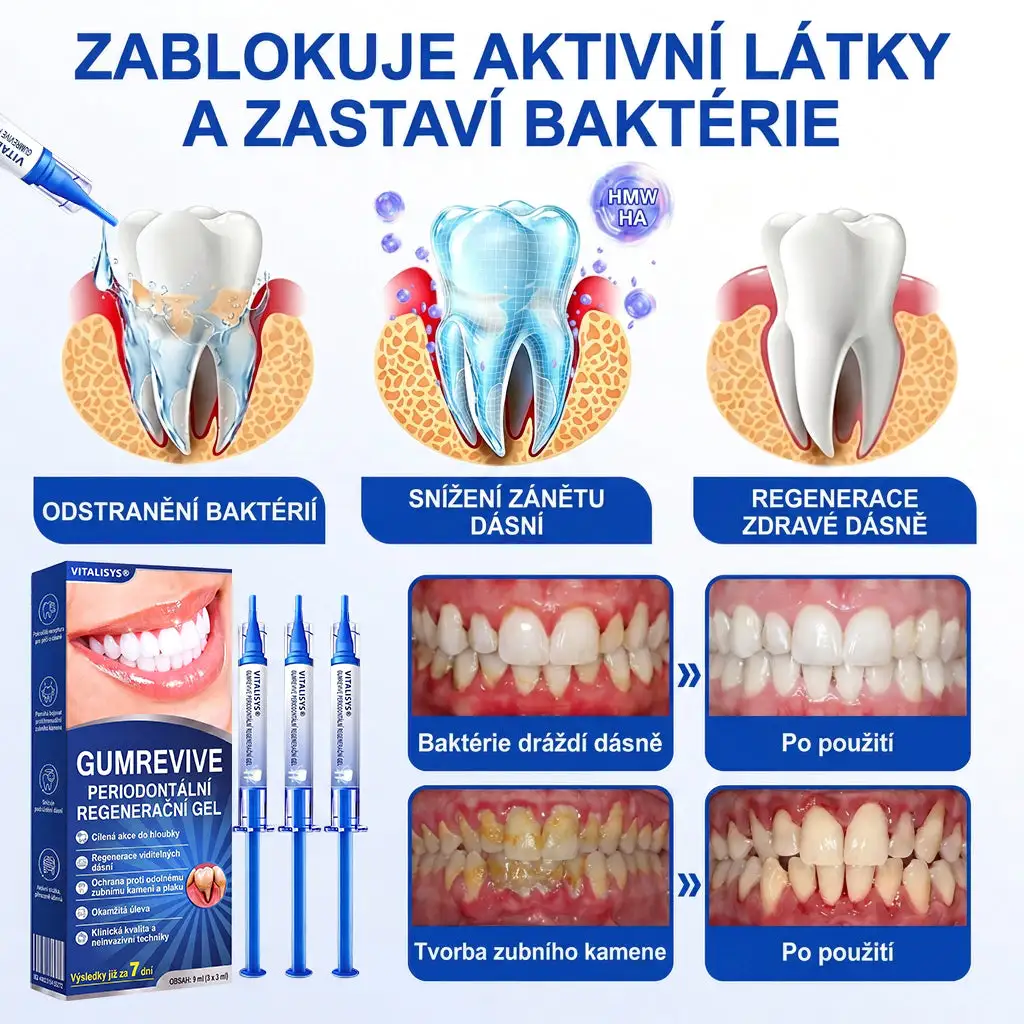 𝐕𝐢𝐭𝐚𝐥𝐢𝐬𝐲𝐬® Parodontální Regenerační Gel GumRevive