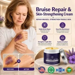 💥75K+ SOLD- TopSpire® Bruise Repair & Skin-Strengthening Cream