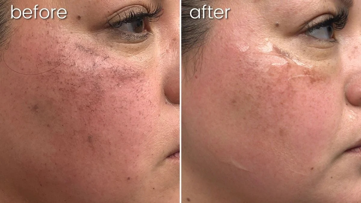 Skavix™ Radiglow Dark Spot Cream