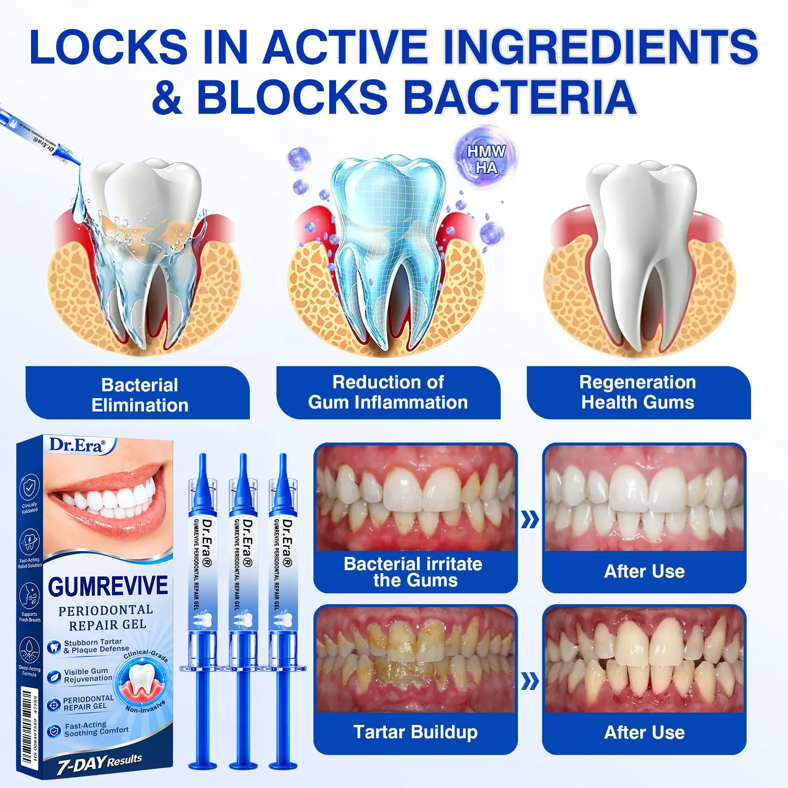 Dr.Era® GumRevive Periodontal Repair Gel