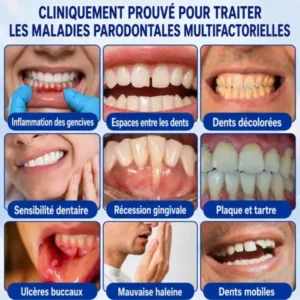 Garageline® GumCare Pro : Gel Parodontal de Précision