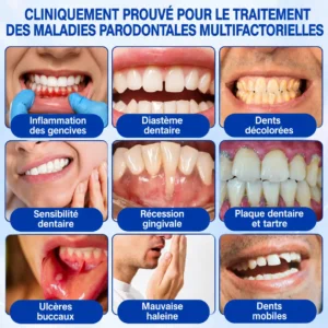 Glimmerly® Gel de Réparation Parodontale GumRevive