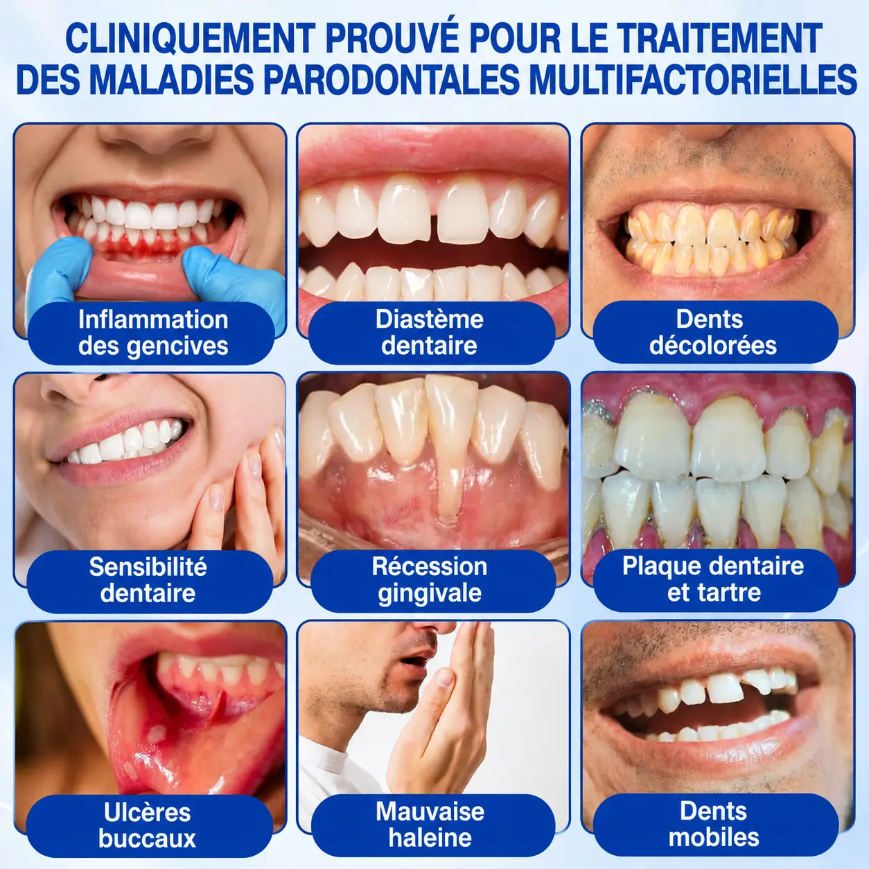 Glimmerly® Gel de Réparation Parodontale GumRevive