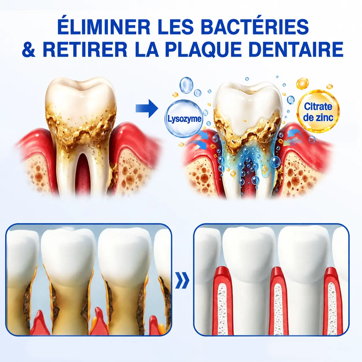 Glimmerly® Gel de Réparation Parodontale GumRevive