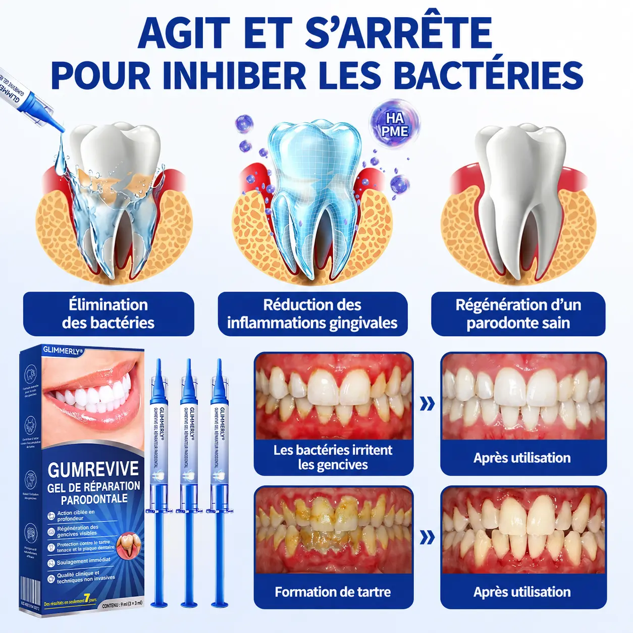 Glimmerly® Gel de Réparation Parodontale GumRevive