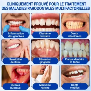 Glimmerly GumRevive – Gel de Réparation Parodontale